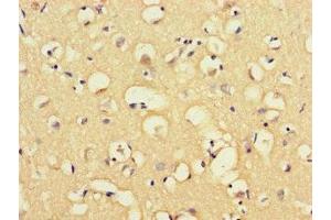 Immunohistochemistry of paraffin-embedded human brain tissue using ABIN7160057 at dilution of 1:100 (MAP3K8 antibody  (AA 1-300))