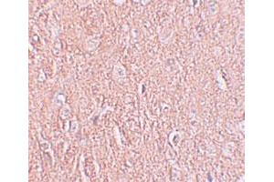 Immunohistochemical staining of human brain cells with LRRTM2 polyclonal antibody  at 2. (LRRTM2 antibody  (C-Term))