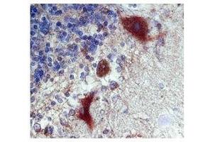 Calbindin 1 in Purkinje neurons in human cerebellum was detected using HRP/DAB brown color stain (CALB1 antibody  (C-Term))