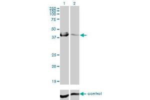 Western blot analysis of CA12 over-expressed 293 cell line, cotransfected with CA12 Validated Chimera RNAi (Lane 2) or non-transfected control (Lane 1).