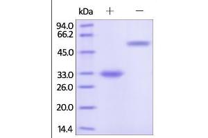 Human IgG4 Fc, Tag Free on SDS-PAGE under reducing (R) and no-reducing (NR) conditions. (HEK-293 Cells IgG4 Isotype Control)