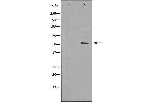 Western blot analysis of extracts from HUVEC cells using PFKFB1 antibody. (PFKFB1 antibody  (C-Term))