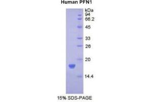 SDS-PAGE (SDS) image for Profilin 1 (PFN1) (AA 1-139) protein (His tag) (ABIN2121941) (PFN1 Protein (AA 1-139) (His tag))