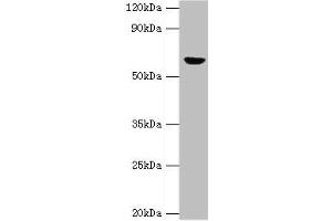 Western blot All lanes: GLUD2 antibody at 2 μg/mL + 293T whole cell lysate Secondary Goat polyclonal to rabbit IgG at 1/10000 dilution Predicted band size: 61 kDa Observed band size: 61 kDa (GLUD2 antibody  (AA 319-558))