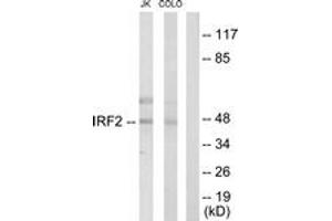 Western blot analysis of extracts from Jurkat/COLO205 cells, using IRF2 Antibody. (IRF2 antibody  (AA 101-150))