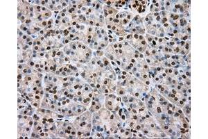 Immunohistochemical staining of paraffin-embedded lung tissue using anti-DAPK2 mouse monoclonal antibody. (DAPK2 antibody)