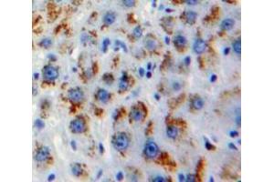 Used in DAB staining on fromalin fixed paraffin-embedded Liver tissue (GOLM1 antibody  (AA 119-223))