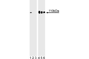 Western Blotting (WB) image for anti-Retinoblastoma 1 (RB1) (pSer780) antibody (ABIN967604) (Retinoblastoma 1 antibody  (pSer780))