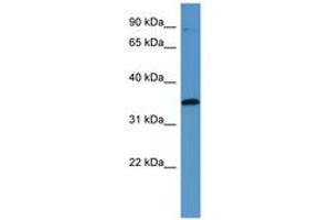 Image no. 1 for anti-Mitogen-Activated Protein Kinase-Activated Protein Kinase 3 (MAPKAPK3) (C-Term) antibody (ABIN6746803)