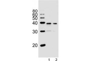 Western blot analysis of lysate from 1) PC3, and 2) LNCaP cell line using VDR antibody at 1:1000. (Vitamin D Receptor antibody  (AA 274-299))