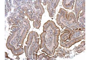 Immunohistochemistry (IHC) image for anti-Angiotensin I Converting Enzyme 2 (ACE2) (N-Term) antibody (ABIN2855030)