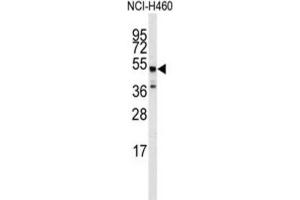 Western Blotting (WB) image for anti-Adrenergic, beta-2-, Receptor, Surface (ADRB2) antibody (ABIN3003093) (beta 2 Adrenergic Receptor antibody)