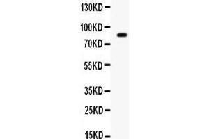 Western blot analysis of SMURF2 expression in SMMC whole cell lysates (lane 1). (SMURF2 antibody  (Middle Region))