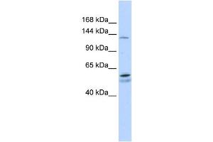 PUM2 antibody used at 1 ug/ml to detect target protein. (PUM2 antibody)