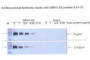 Image no. 1 for anti-Glycoprotein E2 antibody (ABIN1742586)