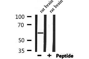 Western blot analysis of extracts from rat brain, using HARS Antibody. (HARS1/Jo-1 antibody  (C-Term))