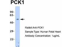 Western Blotting (WB) image for anti-phosphoenolpyruvate Carboxykinase 1 (Soluble) (PCK1) (Middle Region) antibody (ABIN2777603)