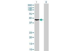 Western Blotting (WB) image for RAD51C 293T Cell Transient Overexpression Lysate(Denatured) (ABIN1333252)
