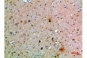 Immunohistochemical analysis of paraffin-embedded human-brain, antibody was diluted at 1:200 (PDGFC antibody  (AA 61-110))