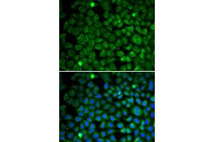 Immunofluorescence analysis of U2OS cells using NUP62 antibody. (NUP62 antibody)