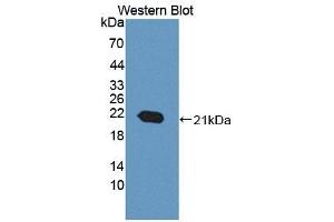 Detection of Recombinant ACD, Mouse using Polyclonal Antibody to Adrenocortical Dysplasia Homolog (ACD) (ACD antibody  (AA 21-175))