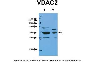 WB Suggested Anti-VDAC2 Antibody    Titration:  1. (VDAC2 antibody  (N-Term))