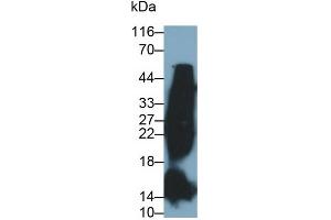 Detection of HbA1c in Human Blood Cells lysate using Monoclonal Antibody to Glycated Hemoglobin A1c (HbA1c) (HbA1c antibody)