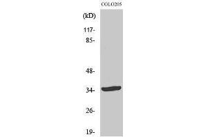 Western Blotting (WB) image for anti-Ubiquitin Thioesterase OTU1 (YOD1) (Internal Region) antibody (ABIN3186223)