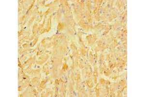 Immunohistochemistry of paraffin-embedded human heart tissue using ABIN7158138 at dilution of 1:100 (LRRC15 antibody  (AA 301-538))
