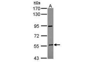 Image no. 1 for anti-Cytochrome P450, Family 4, Subfamily F, Polypeptide 12 (CYP4F12) (AA 133-322) antibody (ABIN1497740) (CYP4F12 antibody  (AA 133-322))