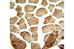 IHC analysis of FFPE human skeletal muscle stained with ULK1 antibody (ULK1 antibody)