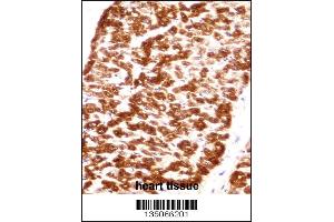 DES/Desmin (Muscle Cell Marker) Antibody immunohistochemistry analysis in formalin fixed and paraffin embedded human heart tissue followed by peroxidase conjugation of the secondary antibody and DAB staining. (Desmin antibody  (C-Term))