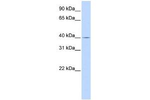 SLC22A18 antibody used at 1 ug/ml to detect target protein. (ORCTL-2/SLC22A18 antibody  (Middle Region))