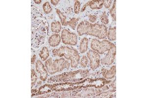 Immunohistochemical analysis of ABIN6242882 on paraffin-embedded Human kidney tissue. (VDAC2 antibody  (N-Term))