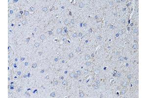 Immunohistochemistry of paraffin-embedded rat brain using RYR2 Antibody (ABIN5970123) at dilution of 1/100 (40x lens). (RYR2 antibody)