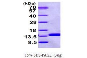 SDS-PAGE (SDS) image for beta-2-Microglobulin (B2M) (AA 21-119) protein (His tag) (ABIN7529151) (beta-2 Microglobulin Protein (AA 21-119) (His tag))