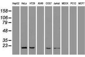 Western blot analysis of extracts (35 µg) from 9 different cell lines by using anti-AK1 monoclonal antibody. (Adenylate Kinase 1 antibody)