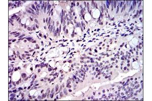 Immunohistochemistry (IHC) image for anti-S-Phase Kinase-Associated Protein 1 (SKP1) antibody (ABIN969397)