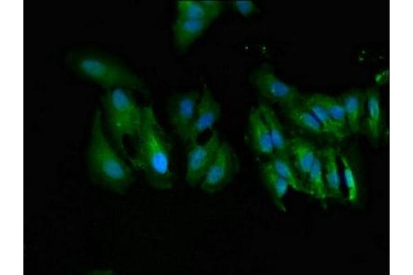 UGT1A9 anticorps  (AA 277-473)