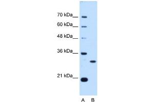 PSME3 antibody used at 0. (PSME3 antibody  (N-Term))