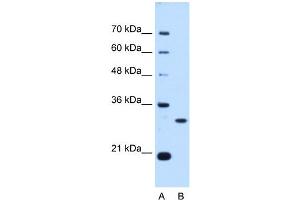 PSME3 antibody used at 0.