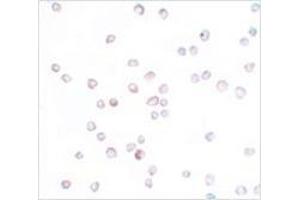 Immunocytochemistry of SCUBE2 in Daudi cells with SCUBE2 antibody at 20 μg/ml. (SCUBE2 antibody  (Center))