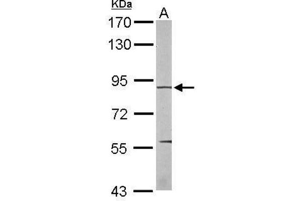 EEF2K anticorps  (N-Term)