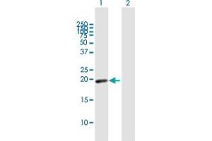 Western Blot analysis of MYL7 expression in transfected 293T cell line by MYL7 MaxPab polyclonal antibody. (MYL7 antibody  (AA 1-175))