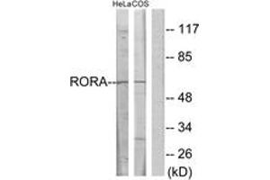 Western blot analysis of extracts from HeLa/COS7 cells, using RORA Antibody. (RORA antibody  (AA 6-55))