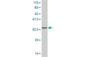 Western Blot detection against Immunogen (35. (FRZB antibody  (AA 102-190))