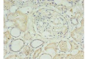 Immunohistochemistry of paraffin-embedded human kidney tissue using ABIN7159152 at dilution of 1:100 (MED27 antibody  (AA 67-165))