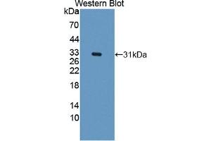Figure. (CARD9 antibody  (AA 26-283))