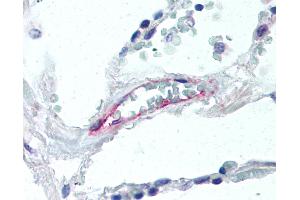 Anti-DARC antibody IHC of human lung, vessel. (DARC antibody  (PE))