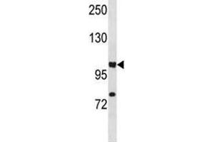 Western Blotting (WB) image for anti-Hypoxia Inducible Factor 1, alpha Subunit (Basic Helix-Loop-Helix Transcription Factor) (HIF1A) (AA 735-762) antibody (ABIN3031278)